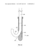 Methods, Materials and Apparatus for Treating Bone and Other Tissue diagram and image