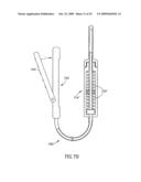 Methods, Materials and Apparatus for Treating Bone and Other Tissue diagram and image