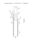 Methods, Materials and Apparatus for Treating Bone and Other Tissue diagram and image