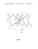 Family of Electrodes for Use in Performing in Situ Fenestration Using a Plasma RF Catheter diagram and image