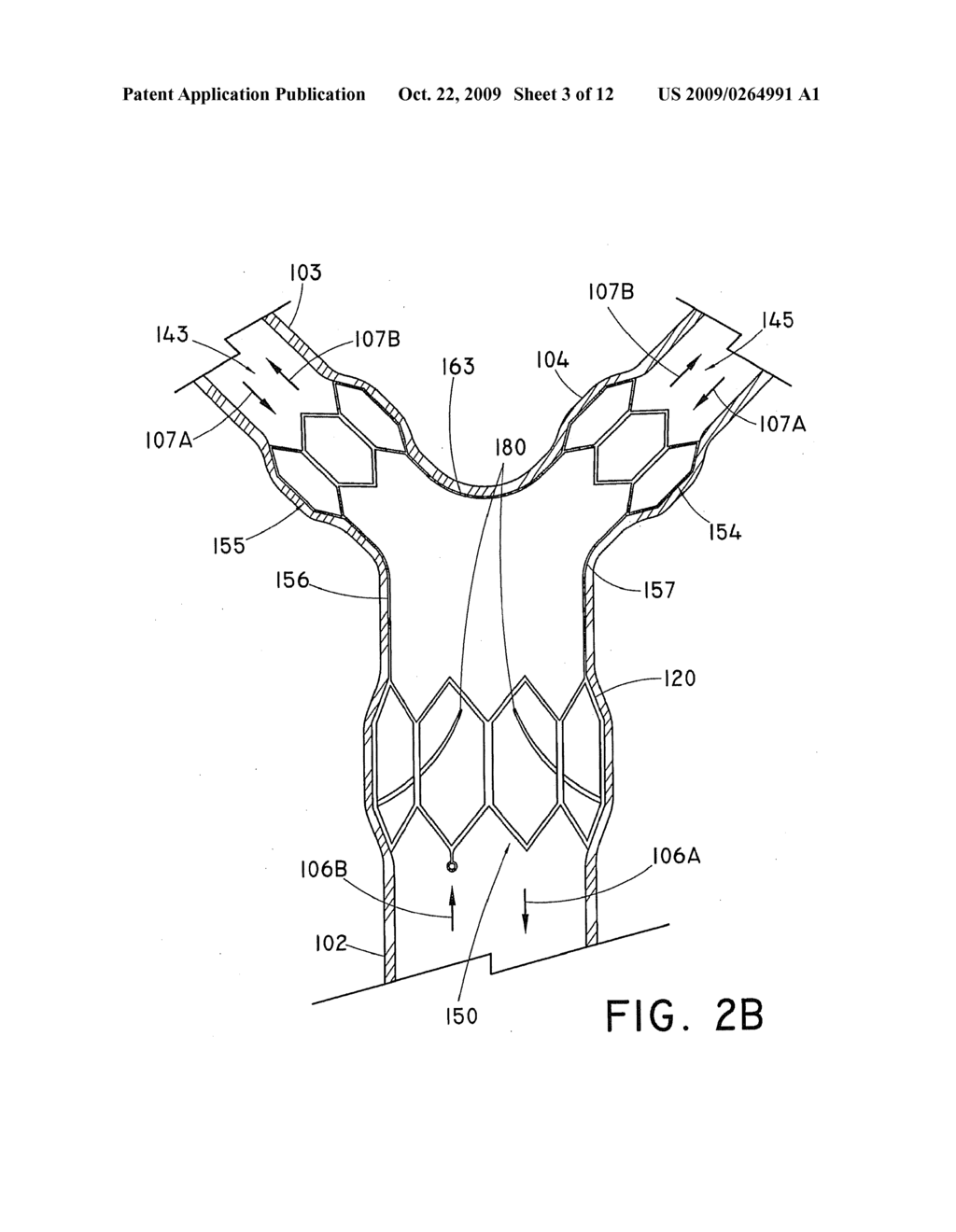 BRANCHED VESSEL PROSTHESIS - diagram, schematic, and image 04