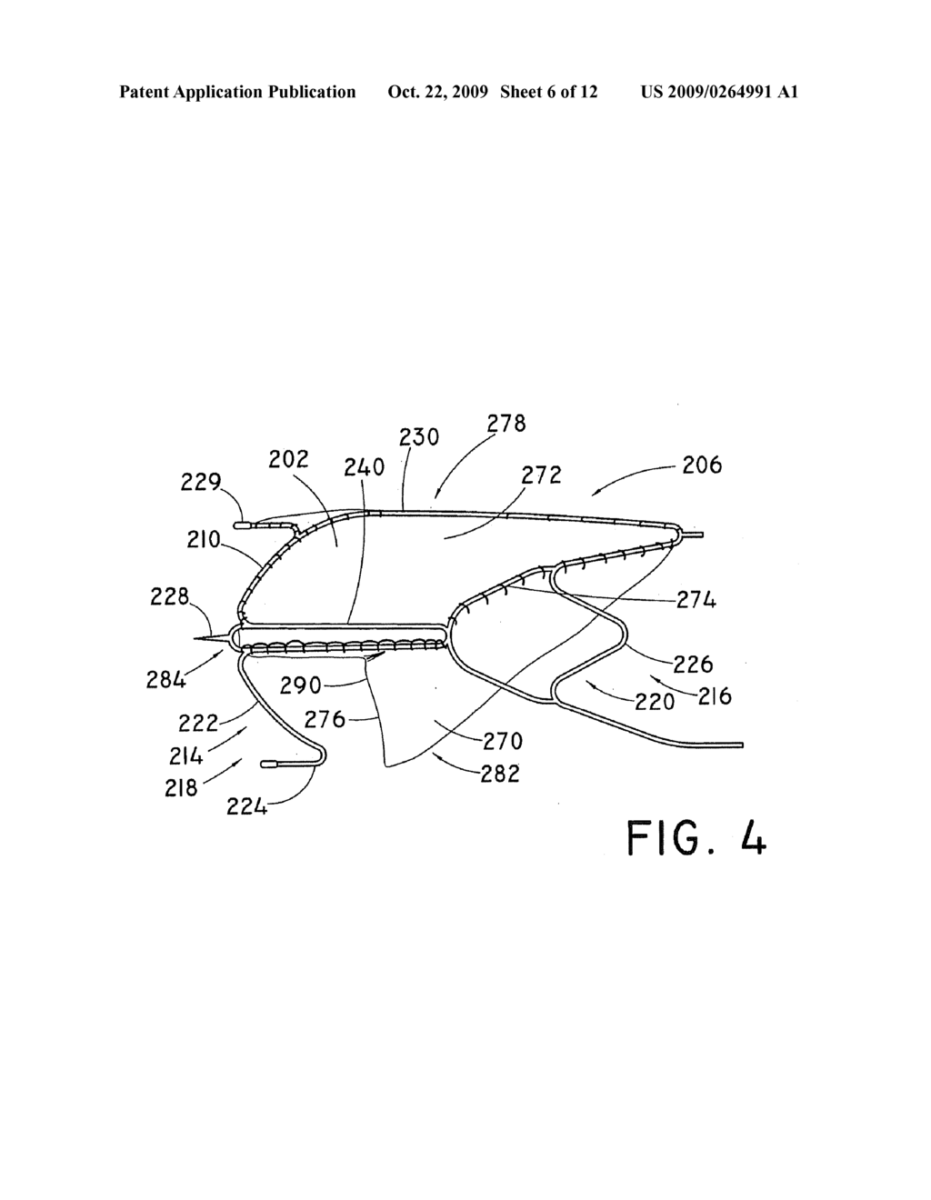 BRANCHED VESSEL PROSTHESIS - diagram, schematic, and image 07