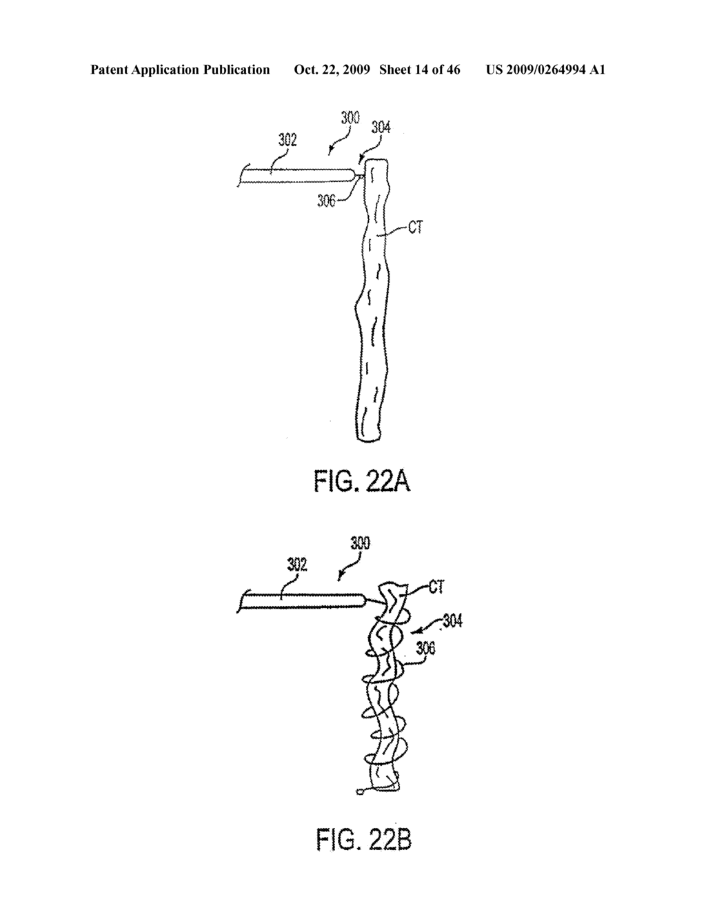 APPARATUS AND METHODS FOR TREATING TISSUE - diagram, schematic, and image 15