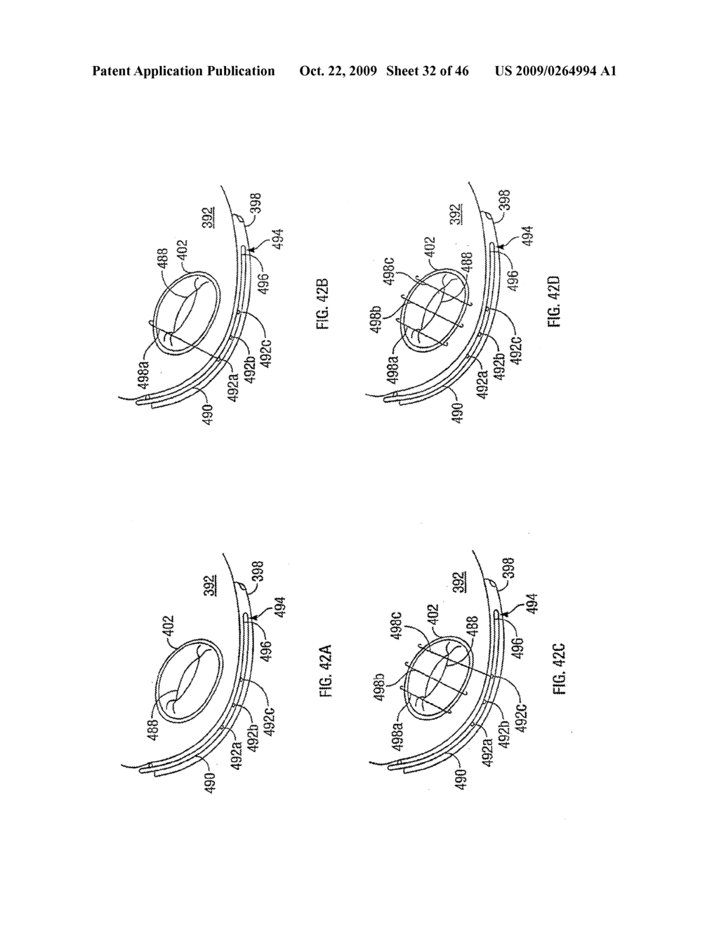 APPARATUS AND METHODS FOR TREATING TISSUE - diagram, schematic, and image 33