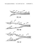 Everting Heart Valve diagram and image