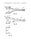 Everting Heart Valve diagram and image