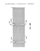 Everting Heart Valve diagram and image