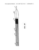 Everting Heart Valve diagram and image