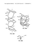 Everting Heart Valve diagram and image