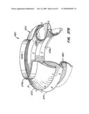 Everting Heart Valve diagram and image