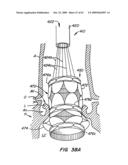 Everting Heart Valve diagram and image