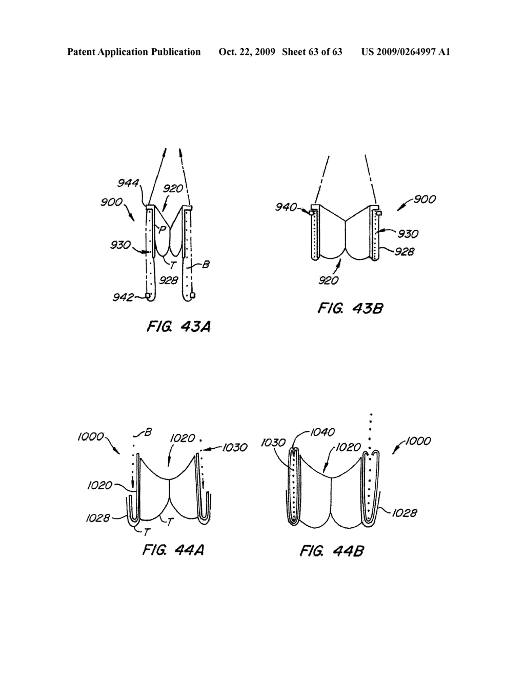 Everting Heart Valve - diagram, schematic, and image 64