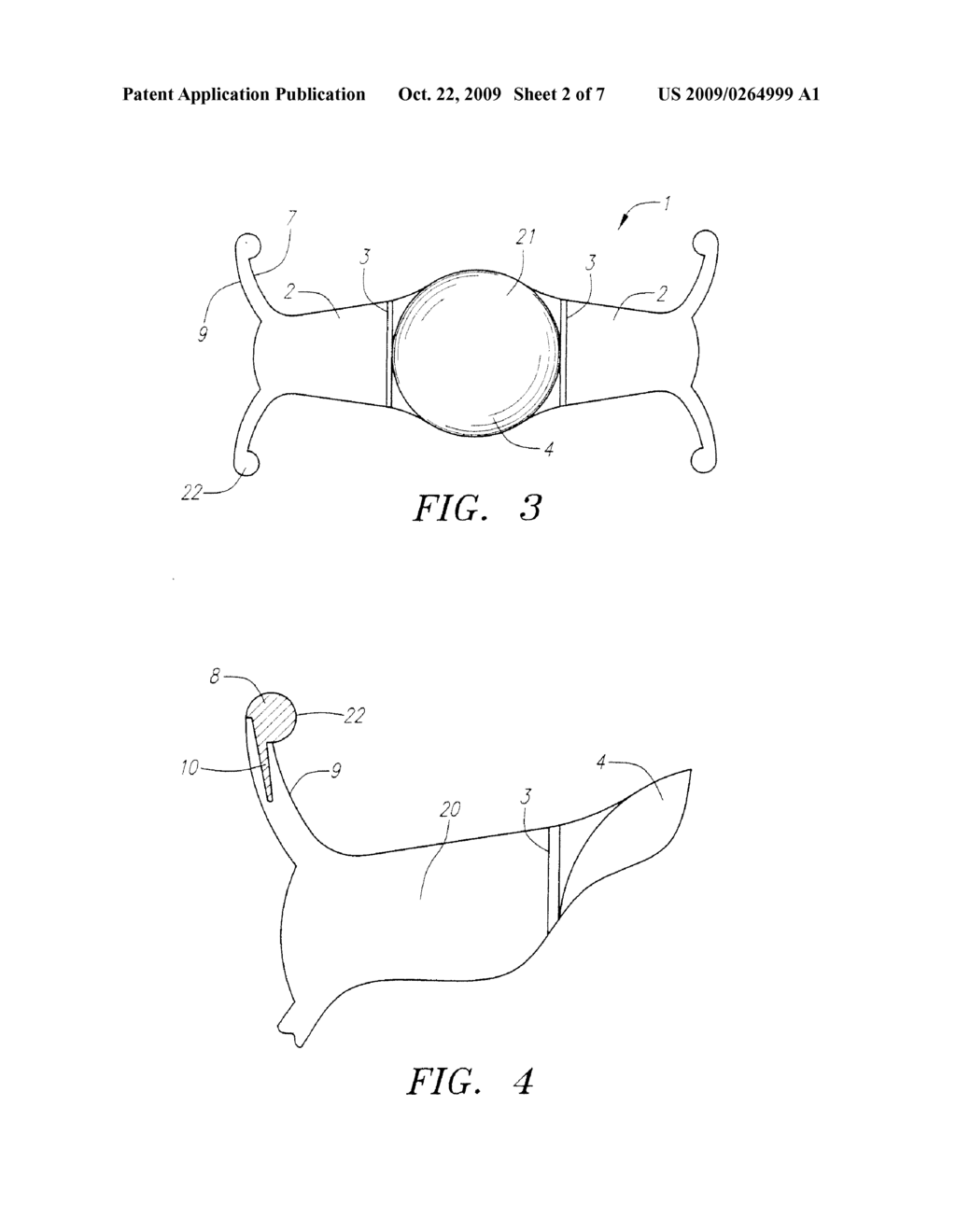 ACCOMMODATING 360 DEGREE SHARP EDGE OPTIC PLATE HAPTIC LENS - diagram, schematic, and image 03