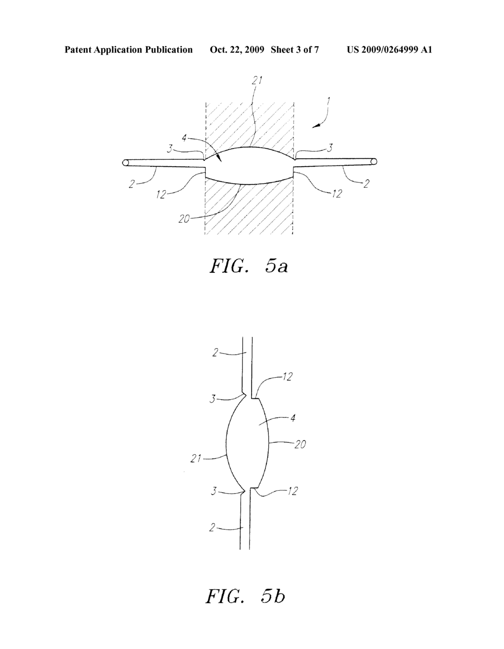 ACCOMMODATING 360 DEGREE SHARP EDGE OPTIC PLATE HAPTIC LENS - diagram, schematic, and image 04