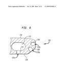 Spinal implant apparatus and methods diagram and image