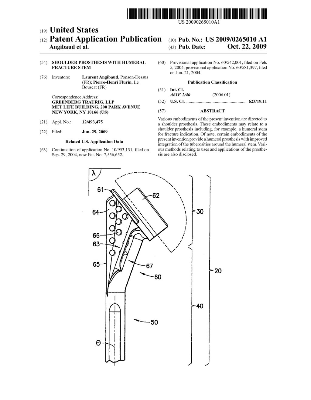 SHOULDER PROSTHESIS WITH HUMERAL FRACTURE STEM - diagram, schematic, and image 01