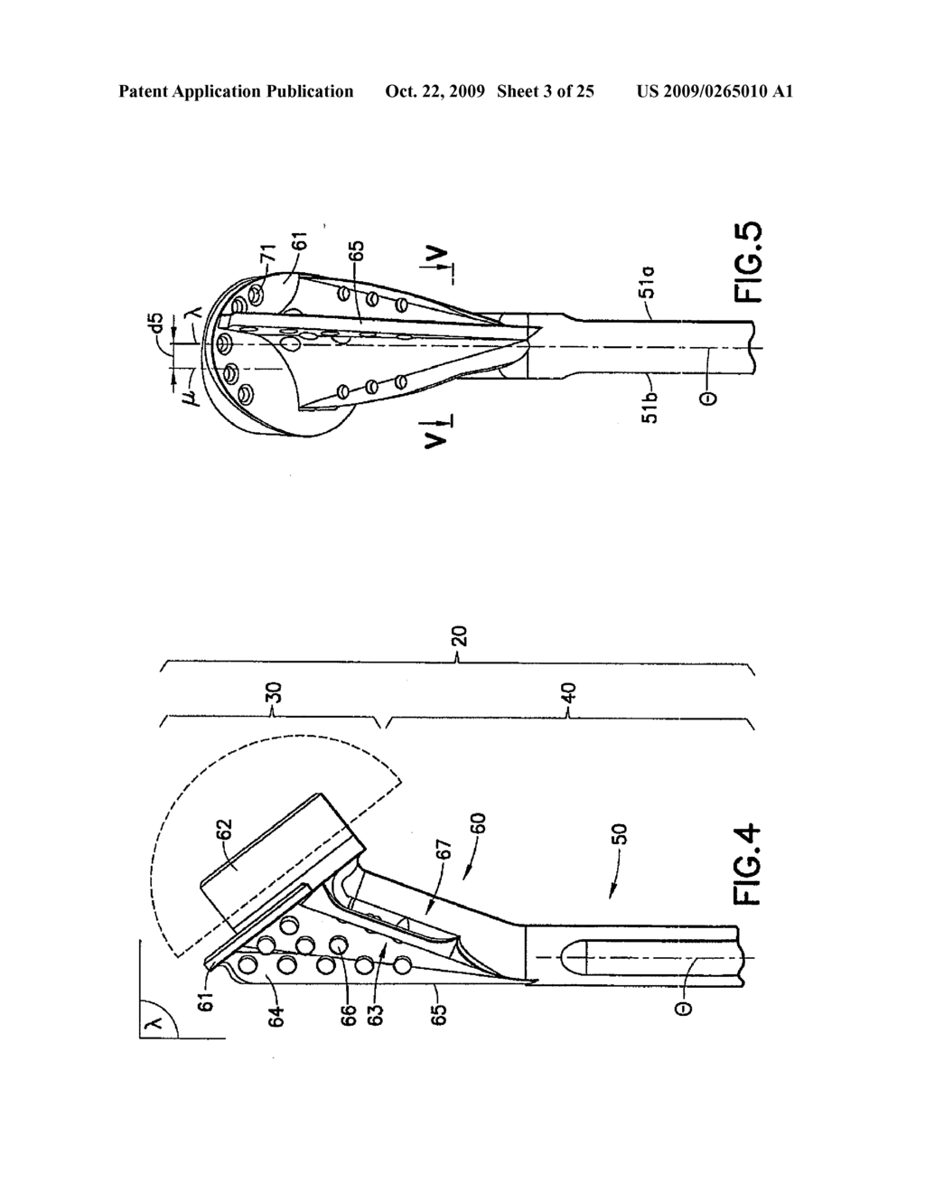 SHOULDER PROSTHESIS WITH HUMERAL FRACTURE STEM - diagram, schematic, and image 04