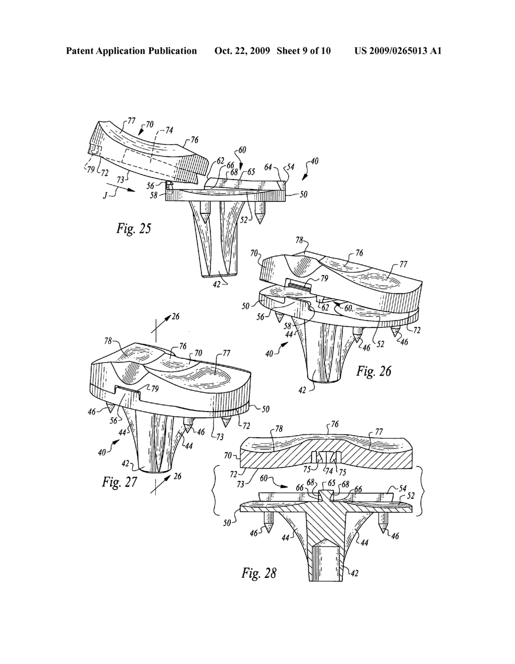 Tibial component of an artificial knee joint - diagram, schematic, and image 10