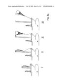 Placement system for a flying kite-type wind-attacked element in a wind-powered watercraft diagram and image