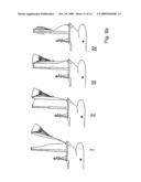 Placement system for a flying kite-type wind-attacked element in a wind-powered watercraft diagram and image