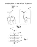 Multiple Sensor for Structure Identification diagram and image