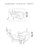 Multiple Sensor for Structure Identification diagram and image