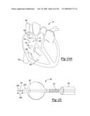 Multiple Sensor for Structure Identification diagram and image