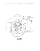 Multiple Sensor for Structure Identification diagram and image