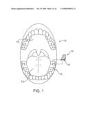 MICROPHONE PLACEMENT FOR ORAL APPLICATIONS diagram and image