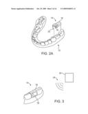 MICROPHONE PLACEMENT FOR ORAL APPLICATIONS diagram and image