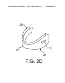 MICROPHONE PLACEMENT FOR ORAL APPLICATIONS diagram and image