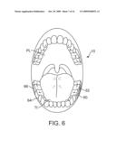 MICROPHONE PLACEMENT FOR ORAL APPLICATIONS diagram and image