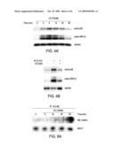 Calcium/Calmodulin-Dependent Protein Kinase Kinase as a Control Point for Cardiac Hypertrophy diagram and image