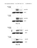 Calcium/Calmodulin-Dependent Protein Kinase Kinase as a Control Point for Cardiac Hypertrophy diagram and image