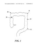 METHOD AND PRODUCT FOR LOCATING AN INTERNAL BLEEDING SITE diagram and image