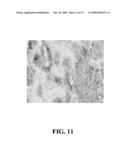 METHODS OF USING ADIPOSE TISSUE-DERIVED CELLS IN THE TREATMENT OF CARDIOVASCULAR CONDITIONS diagram and image