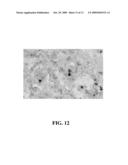 METHODS OF USING ADIPOSE TISSUE-DERIVED CELLS IN THE TREATMENT OF CARDIOVASCULAR CONDITIONS diagram and image