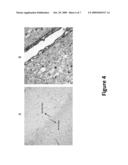 IRREVERSIBLE ELECTROPORATION TO CREATE TISSUE SCAFFOLDS diagram and image