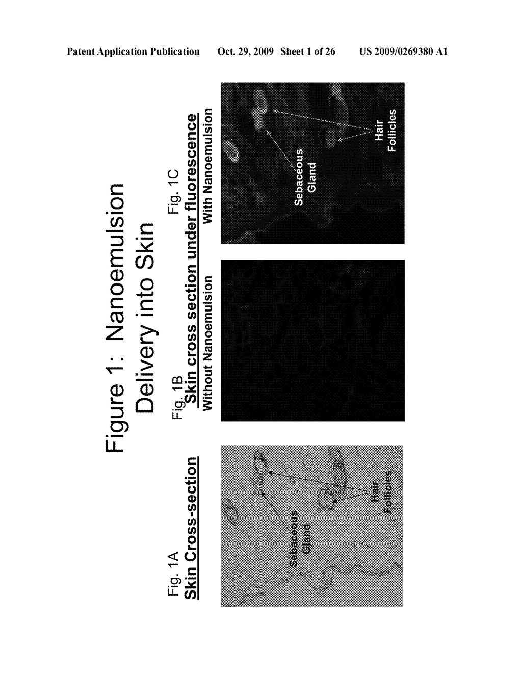 METHODS OF TREATING FUNGAL, YEAST AND MOLD INFECTIONS - diagram, schematic, and image 02