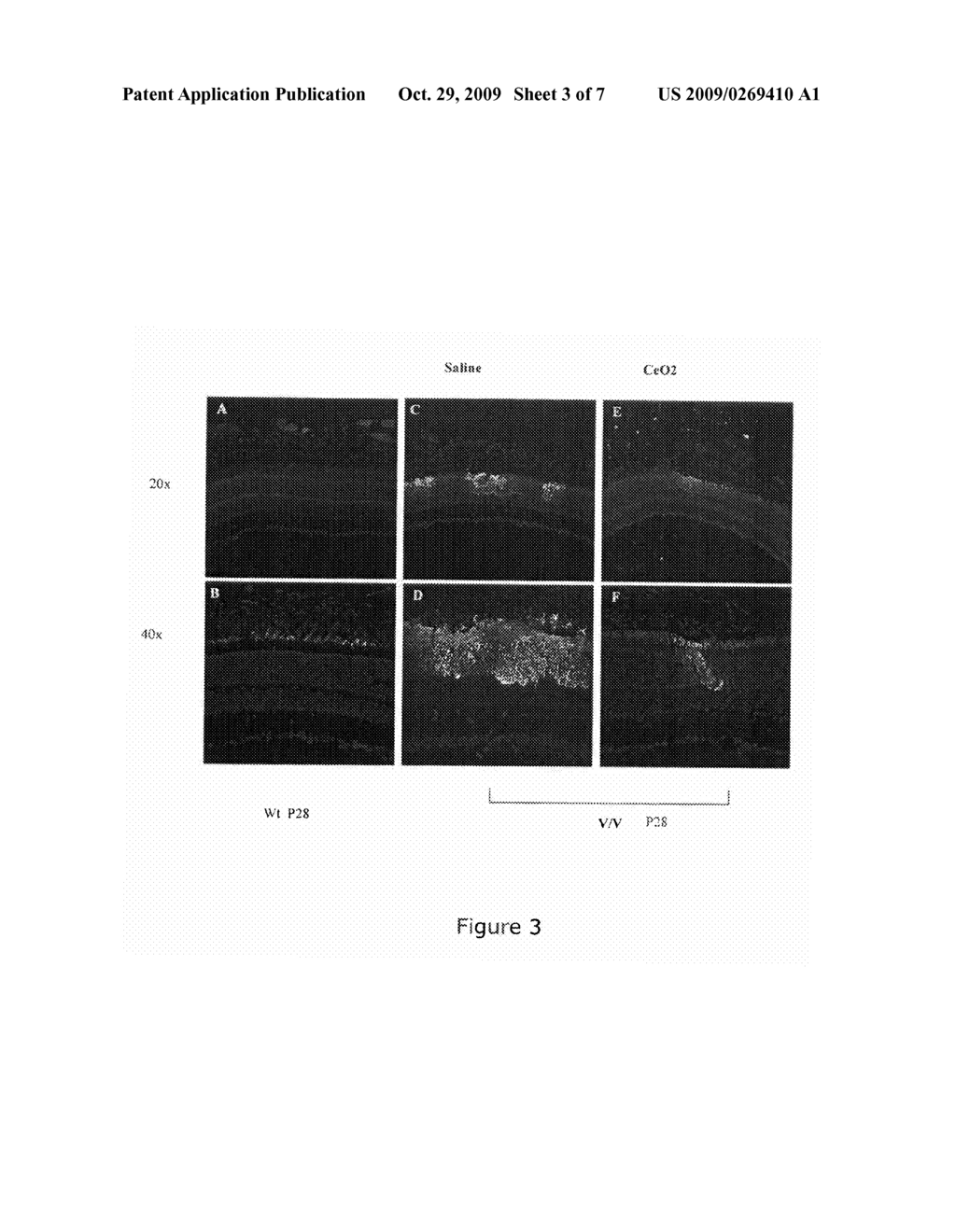 Inhibition of Neovascularization by Cerium Oxide Nanoparticles - diagram, schematic, and image 04