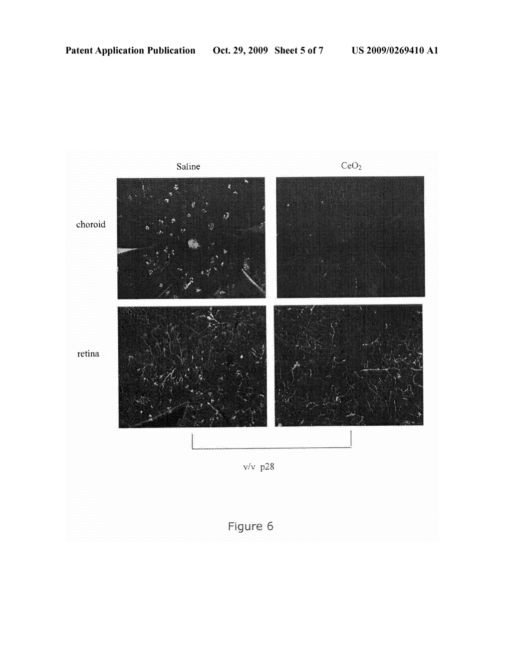 Inhibition of Neovascularization by Cerium Oxide Nanoparticles - diagram, schematic, and image 06