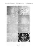 Culture System and Method for Propagation of Human Blastocyst-Derived Stem Cells diagram and image