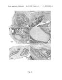 Culture System and Method for Propagation of Human Blastocyst-Derived Stem Cells diagram and image