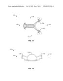 GOLF CLUB HEAD WITH A THREE-DIMENSIONAL ALIGNMENT MEMBER AND METHODS TO MANUFACTURE GOLF CLUB HEADS diagram and image