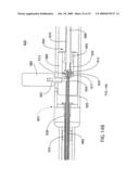 IMAGING CATHETER diagram and image