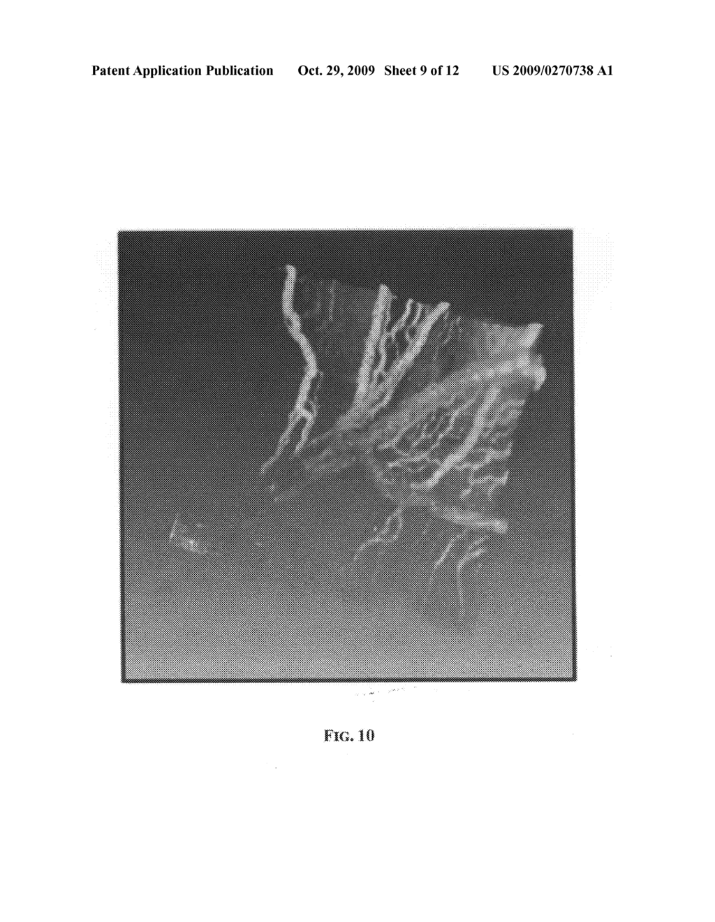 Methods for single-pass volumetric bidirectional blood flow imaging Spectral Domain Optical Coherence Tomography using a modified hilbert transform - diagram, schematic, and image 10