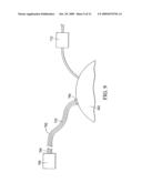 MIXED-GAS INSUFFLATION SYSTEM diagram and image