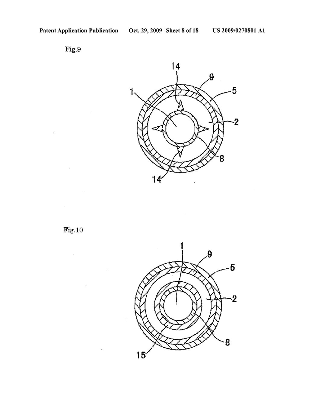 Catheter - diagram, schematic, and image 09