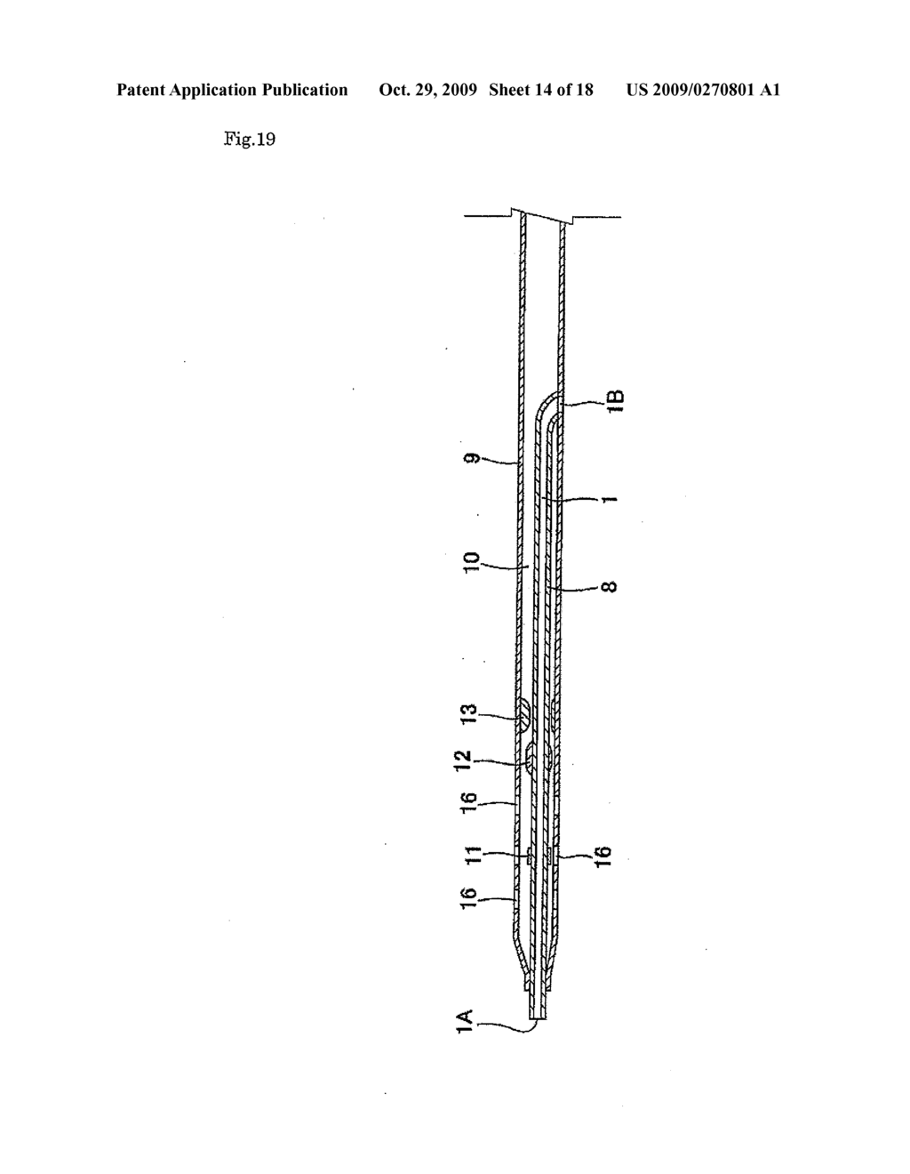 Catheter - diagram, schematic, and image 15