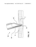 OPTICAL SAFETY TROCAR AND METHOD OF USE THEREOF diagram and image